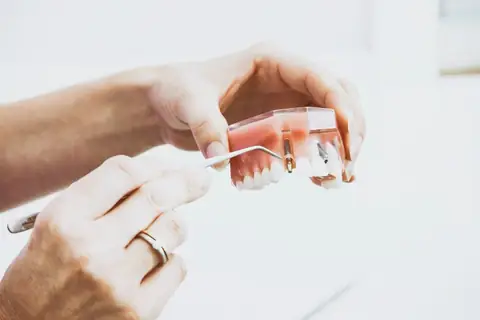 Everything You Should Know Before Getting Dental Implants