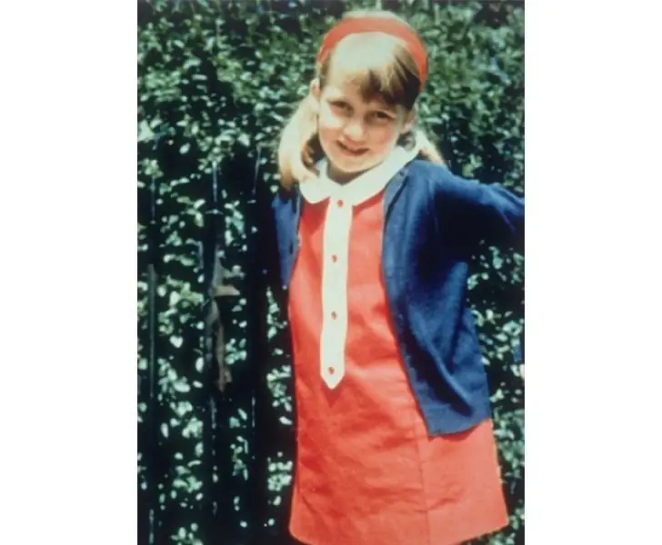 A Scarred Childhood