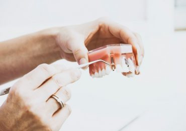 dental-implants-4